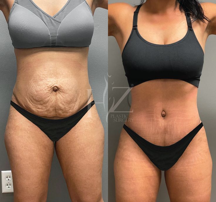 Client transformation — Lost 24 lbs